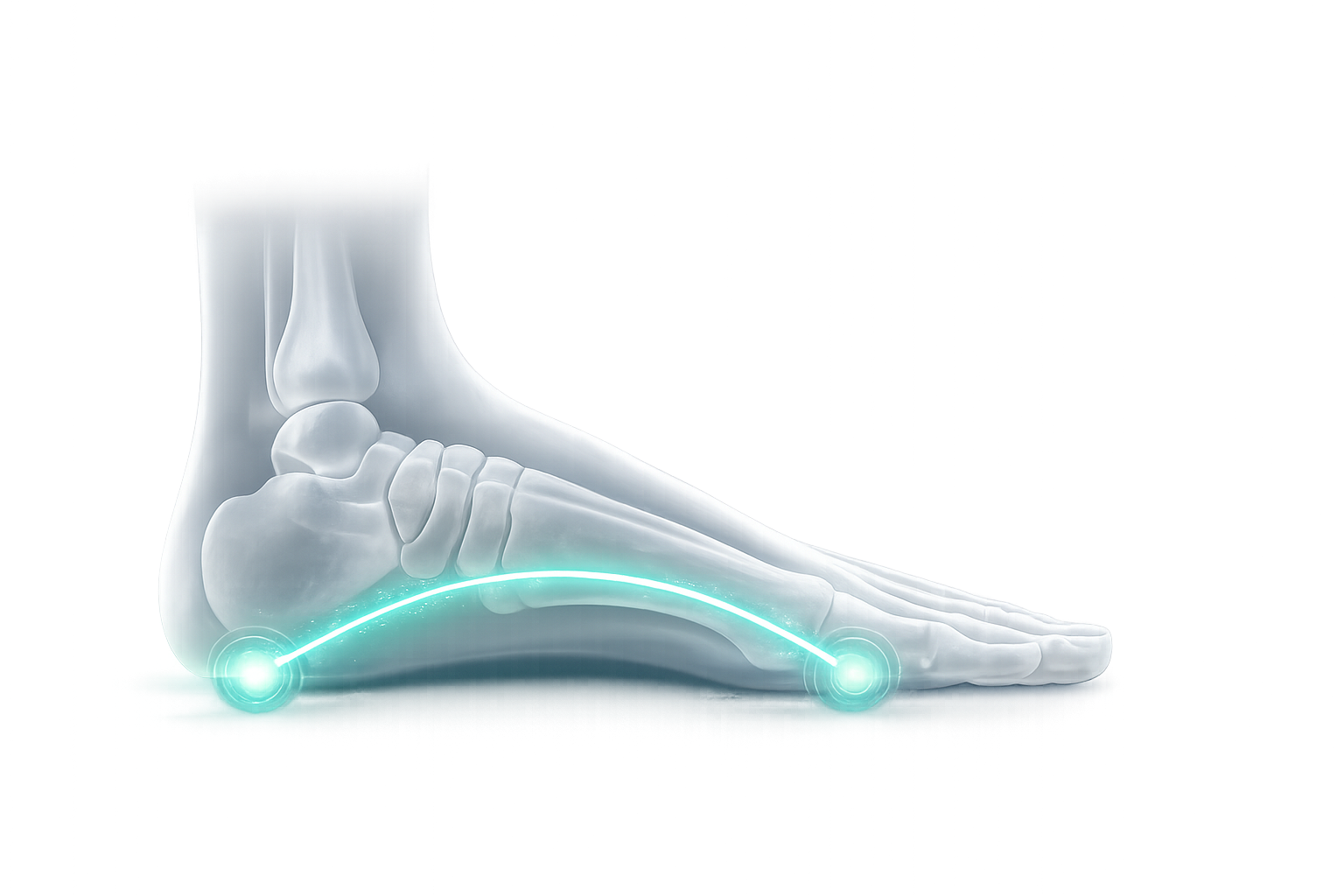 Foot profile illustrating the longitudinal arch